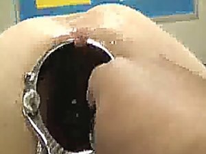 ショッキング肛門鏡ぽっかりとフィスト
