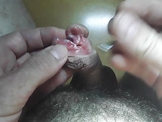 เจาะและ subincision